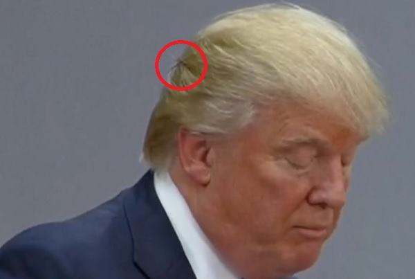 Donald Trump Had Visible Bobby Pins Holding His Hair Still at